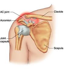 Shoulder AC joint injury