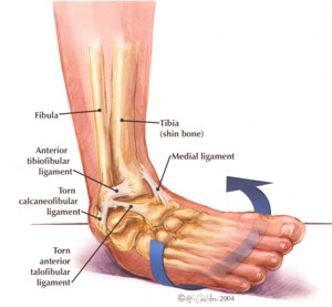 ankle injuries