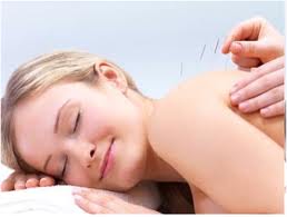 What is dry needling?