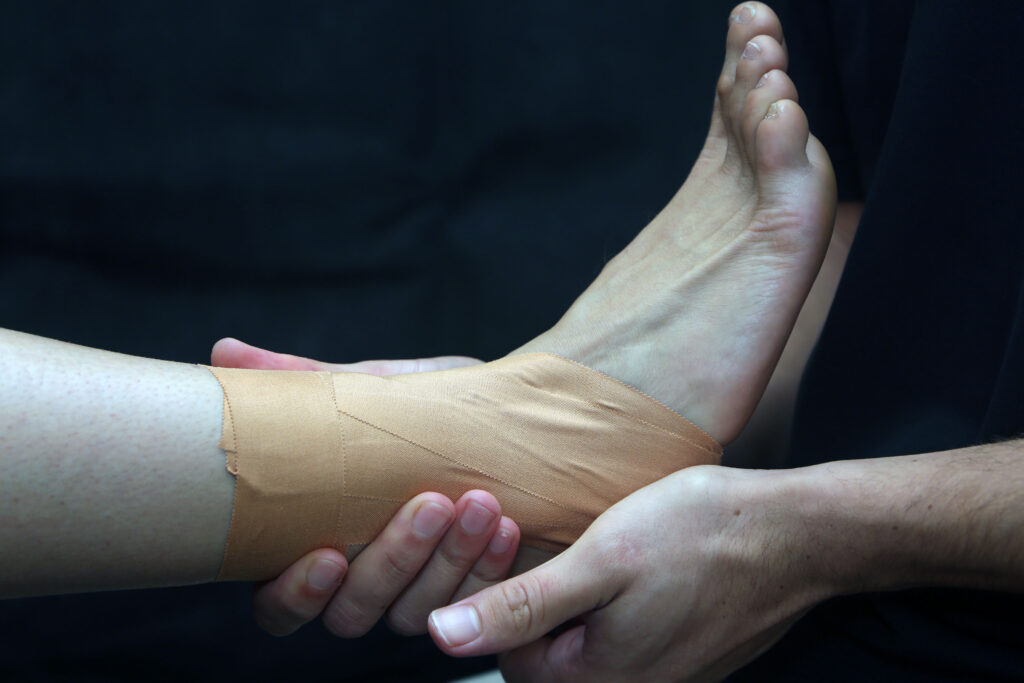 ankle strapping article image