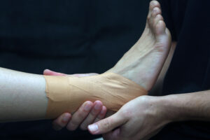 How to Strap a Sprained Ankle: Avoid These Common Mistakes