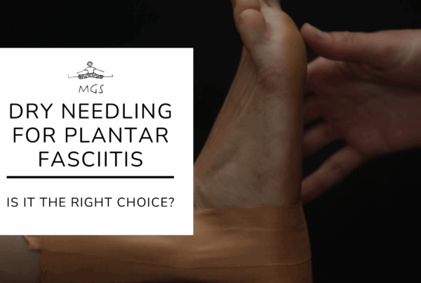 Is Dry Needling the Right Choice for Your Plantar Fasciitis?