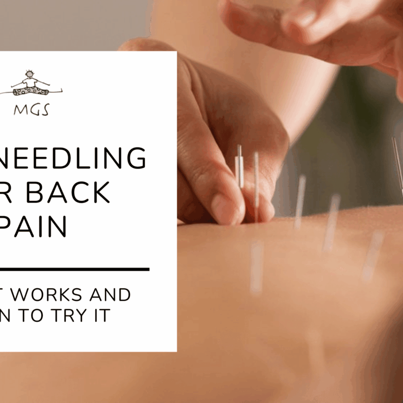 Dry Needling for Back Pain | When to Try It | MGS Physio